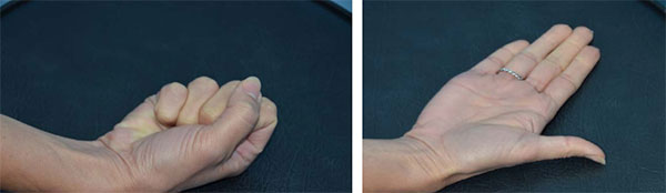 Wrist Exercises